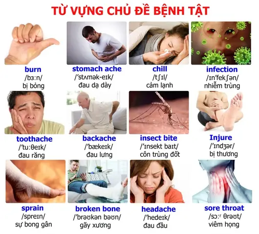 Bị Trùng Tiếng Anh Là Gì