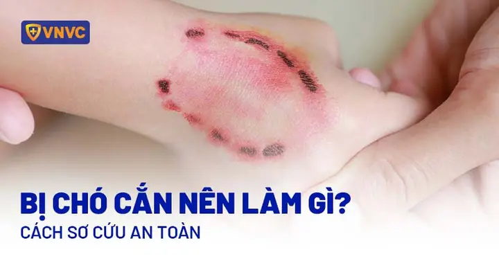 Chó Cắn Tiếng Anh Là Gì