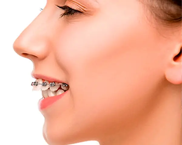 Hô Tiếng Anh Là Gì Hô Tiếng Anh Là Gì