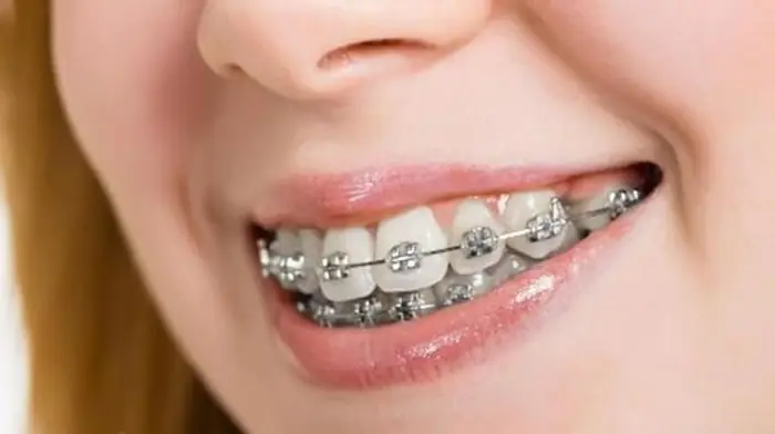 Mắc Tiền Tiếng Anh Là Gì