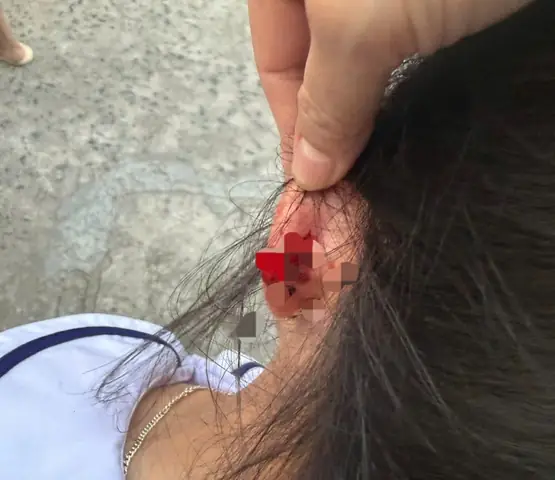 Nhéo Tiếng Anh Là Gì Nhéo Tiếng Anh Là Gì