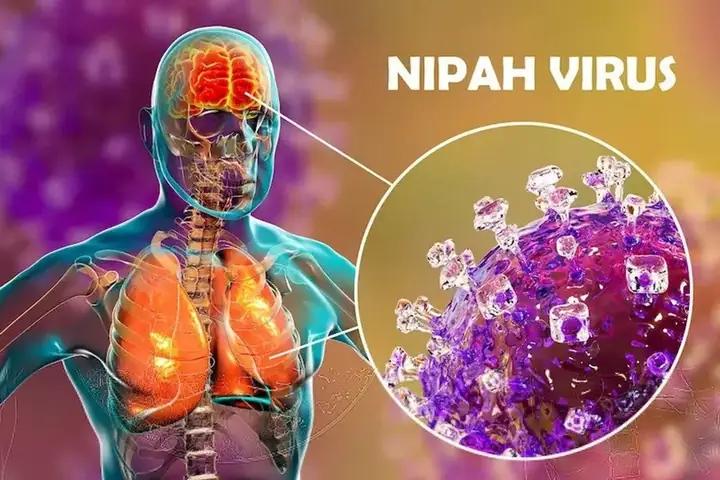 Khuyến Cáo Tiếng Anh Là Gì