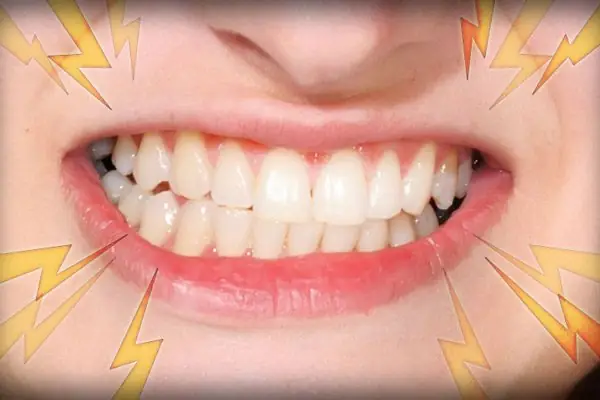 Nghiến Răng Tiếng Anh Là Gì Nghiến Răng Tiếng Anh Là Gì